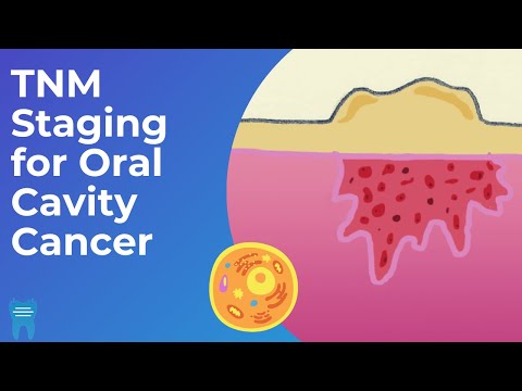 How do we stage oral cancer? | TNM Classification and Staging for Oral Cavity Cancers