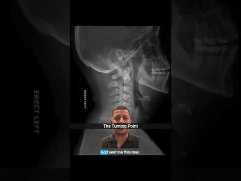 Dizziness Gone After Remote Curve Correction (Kevin's Story Pt. 2) #shorts