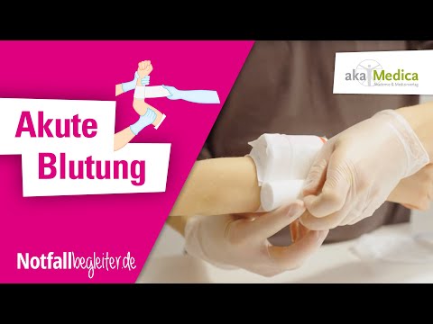 Akute Blutung   Erste Hilfe bei Babys und Kindern – Notfallbegleiter 24