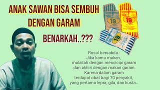 Download lagu CARA MENGOBATI SAWAN PADA ANAK||sesuai sunah Rosul.. mp3