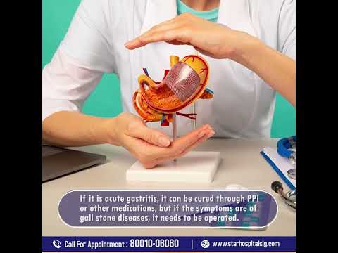 Pain in the Upper Abdomen || Star Hospital Siliguri