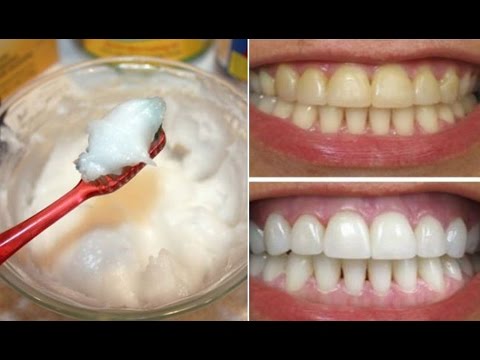 How To Whiten Your Yellow Teeth Naturally At Home (दांत चमकाना)/Tooth Whitening Video