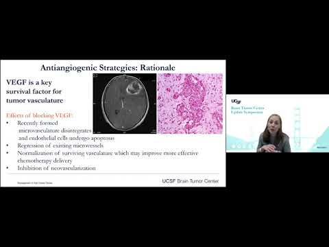 Current Management of High-Grade Gliomas - Nancy Ann Oberheim Bush, MD, PhD