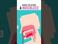 How Do You Actually Stop A Nosebleed Shorts Education