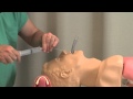Lesson 4 Laryngeal Mask Airway MICU Fellows Airway Course