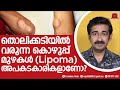 തൊലിക്കടിയിൽ വരുന്ന കൊഴുപ്പ് മുഴകൾ Lip