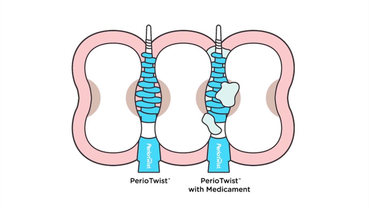 PerioTwist // Reusable Twist Flosser (15 Pack) video thumbnail