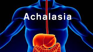 POEM procedure restores achalasia patient’s ability to swallow