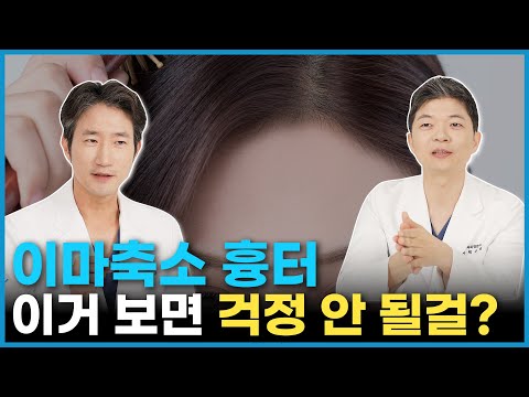 이마축소 흉터 걱정이요?ㅣ성형외과 전문의가 A부터 Z까지 알려드립니다.