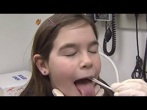 What are the signs and symptoms of strep throat?
