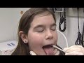 What are the signs and symptoms of strep throat?