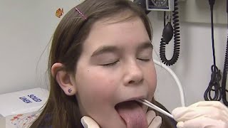 What are the signs and symptoms of strep throat?