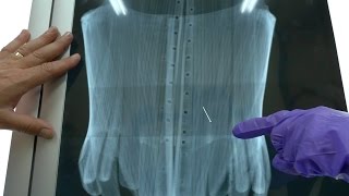 How was it made? X-raying the Fashion Collections