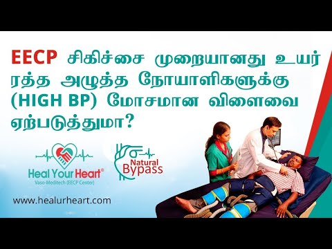 Can EECP Treatment Have Negative Effects on Patients with High Blood Pressure?