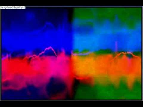 Dj Aligator-Blow my whistle BITCH!