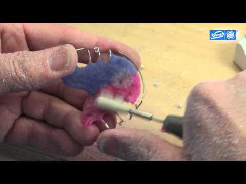 Ausarbeitung und Politur einer Kfo-Platte, Trimming and polishing of an orthodontic plate