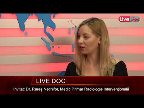 LiveDoc cu dr. Rareș Nechifor. Embolizare pentru fibromul uterin