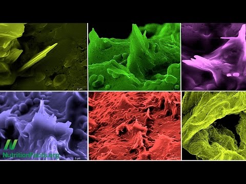 Trans fat saturated fat and cholesterol Tolerable upper intake of zero