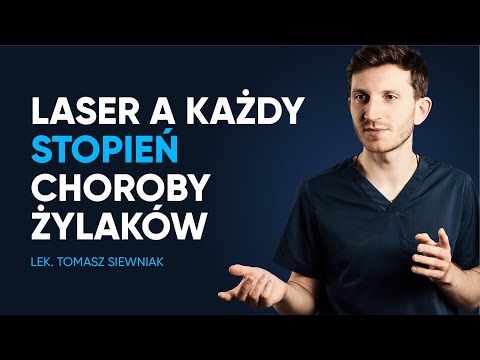 Czy laserowe usuwanie żylaków można stosować w każdym stopniu choroby?
