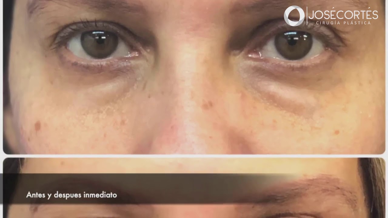 José Cortés Arreguin-36