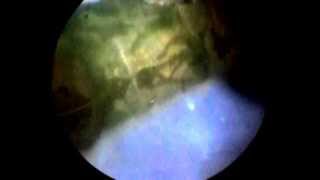 preview picture of video 'Златоглазка под микроскопом (Chrysopidae)'