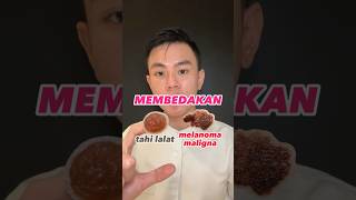 Download lagu Cara Membedakan TAHI LALAT dengan KANKER MELANOMA MALIGNA mp3 Download lagu Cara Membedakan TAHI LALAT dengan KANKER MELANOMA MALIGNA mp3