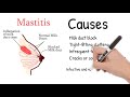 Mastitis - Breast pain during lactation or pregnancy. Mastitis symptoms and treatment.