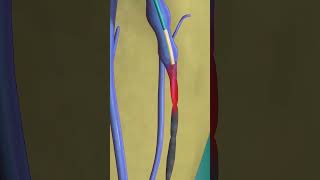 Download lagu Using a laser to zap the varicose veins (3D Animation) #medical3danimation mp3
