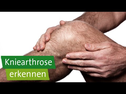 Sie starke Muskelschmerzen im Nacken entfernen Welche Art von Krankheit Osteoarthritis des Knies
