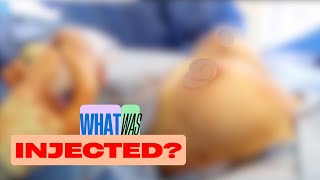 Mysterious Substance Removed from Breasts (Throwback Episode)