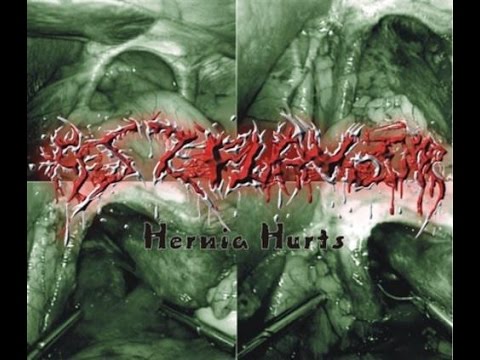 ASS FLAVOUR - Hernia Hurts (2005) [Full Demo CD] (OFFICIAL VIDEO)®