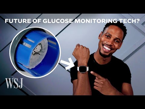 The Real Reason the Apple Watch Lacks Glucose Monitoring