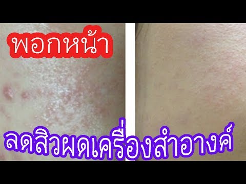 เลิกสูบบุหรี่แรงมีการเรียกคืน ผักชีฝรั่งและครีมสำหรับแรง