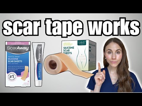 Does Silicone Scar Tape Actually Work?