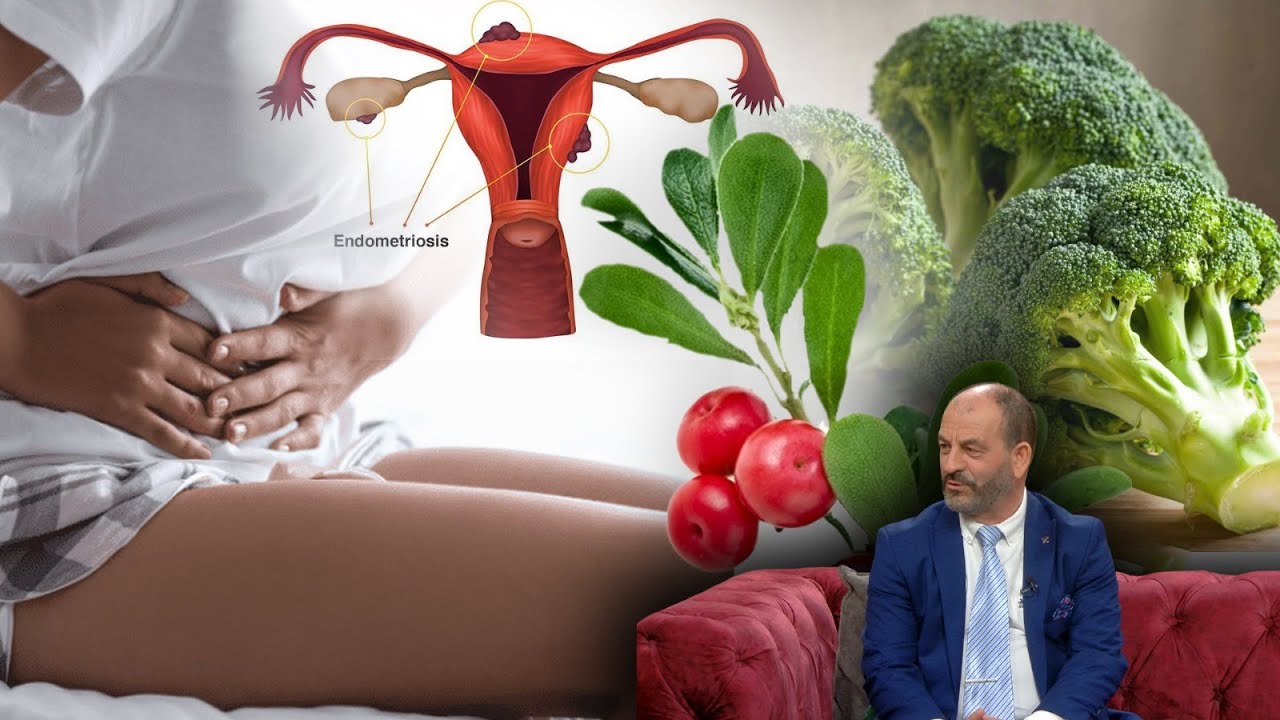 Endometrioza / Ushqimet dhe çajrat që lehtësojnë dhimbjet e frikshme | ABC News Albania