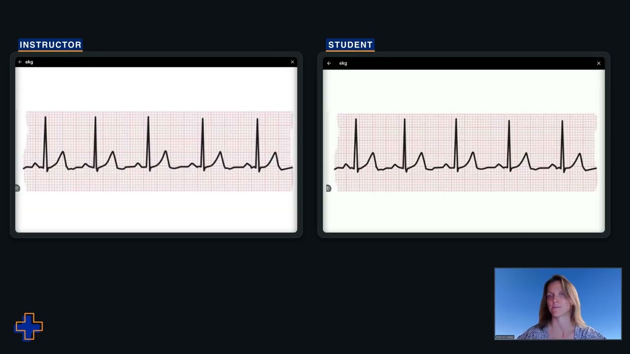 SimVS Hospital: Defibrillator Simulation Overview