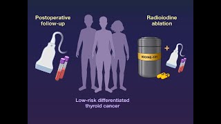 Radioiodine in Low-Risk Thyroid Cancer | NEJM