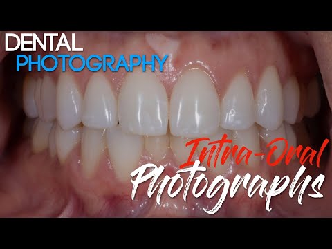 Podstawy fotografii stomatologicznej - techniki wykonywania zdjęć wewnątrzustnych