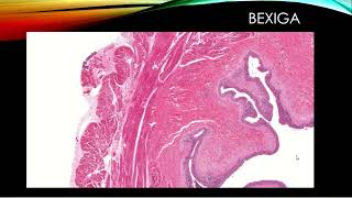 Ureter, uretra e bexiga