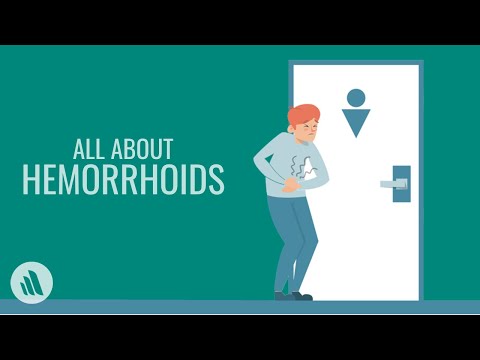 Hemorrhoids: Symptoms, Causes, Treatment, and Prevention | Merck Manual Consumer Version