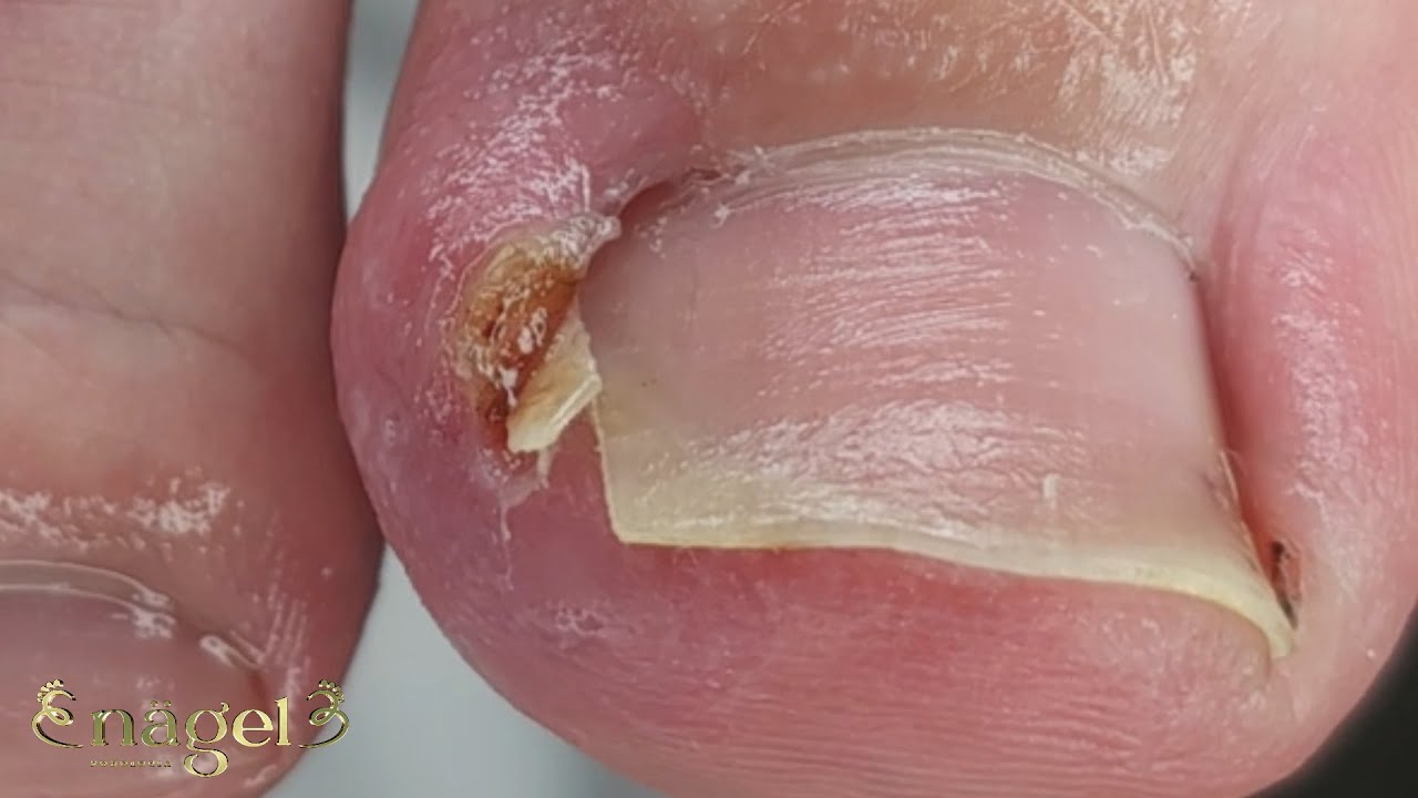 DOR CONSTANTE #satisfying #nails