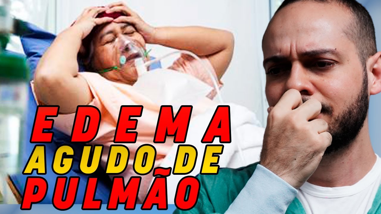 Como tratar um edema agudo de pulmão?