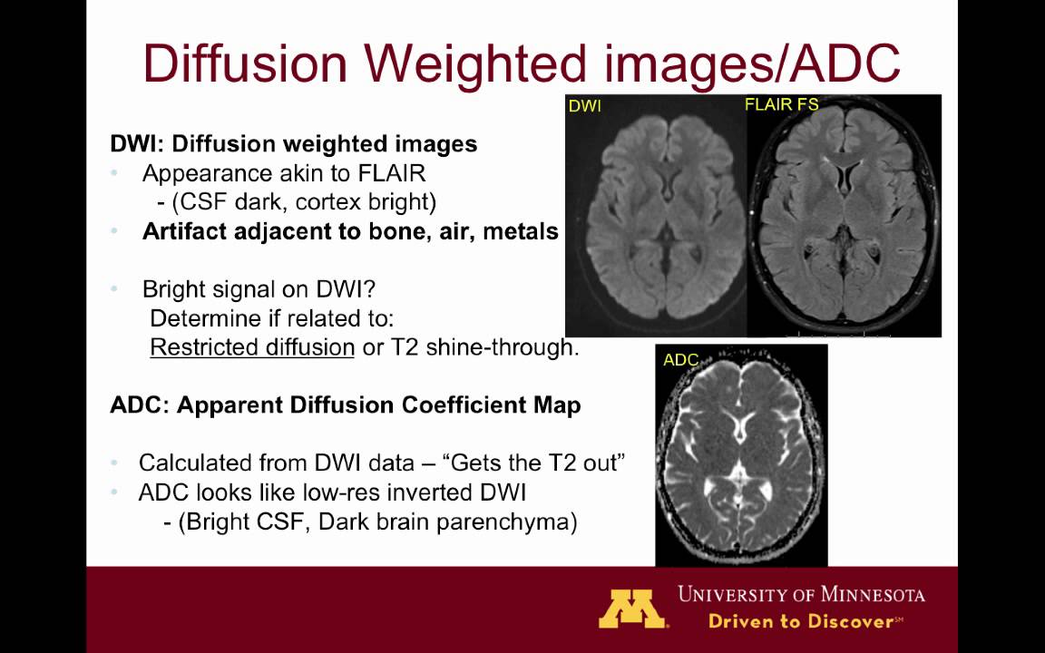 Brain MRI sequences 101