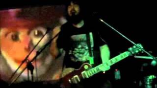 20 Pinback &quot;Prog&quot;