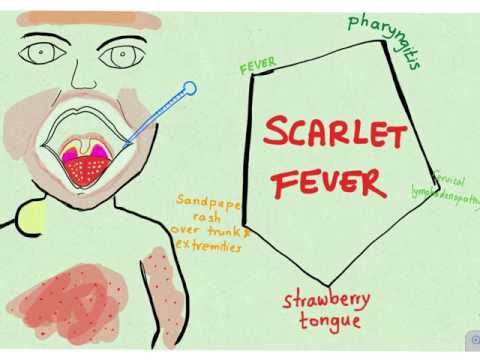 Scarlet fever - visual mnemonic