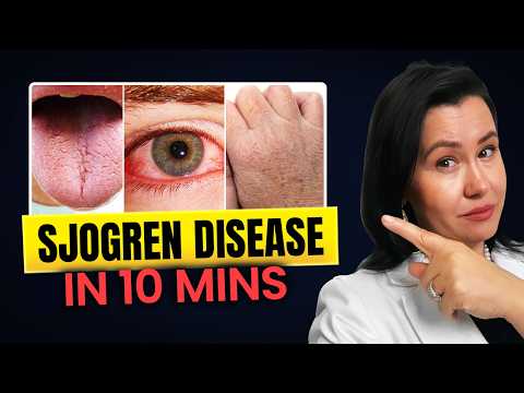 Sjögren’s Disease Explained in 10 Minutes (NEW TREATMENTS DISCUSSED)