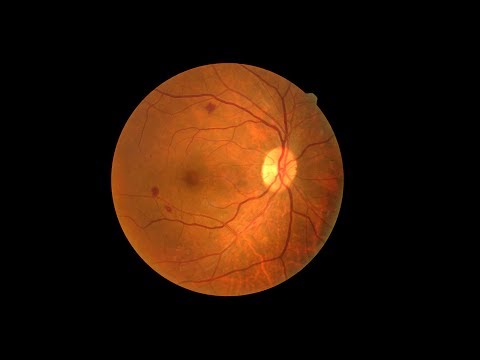A new generation of artificial retinas based on 2D materials