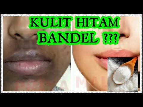 download lagu mp3 mp4 Cara Memutihkan Wajah Gelap Secara Alami, download lagu Cara Memutihkan Wajah Gelap Secara Alami gratis, unduh video klip Cara Memutihkan Wajah Gelap Secara Alami