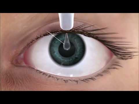 Systane Ultra säilitusaineta niisutavad silmatilgad 10 ml
