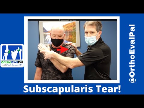 NEER Shoulder Impingement Sign